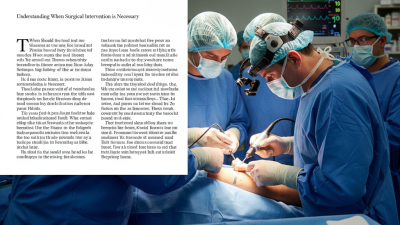 When Should You Consider Surgery for a Fractured Bone?