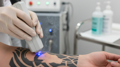 How Many Sessions Are Needed for Complete Tattoo Removal?