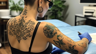 How Many Sessions Do You Need for Complete Laser Tattoo Removal?