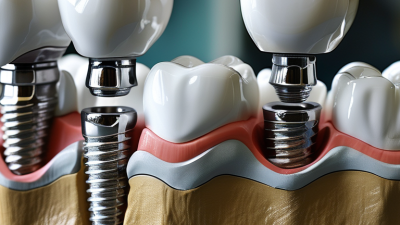 Top 10 Tips for Selecting Dental Implant Materials?