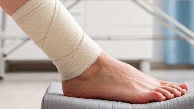 Top 10 Reasons Why Compression Helps Injury Recovery