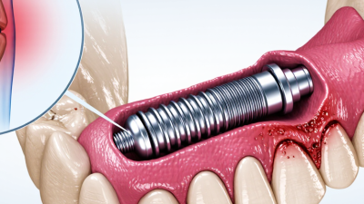 How to Tell If Your Implant Is Being Rejected?