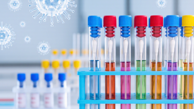 How to Choose Transport Media for Viral Swabs?