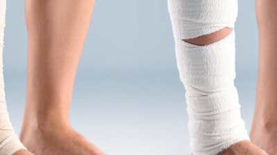 2026 Top How to Choose Elastic vs Non Elastic Bandages?