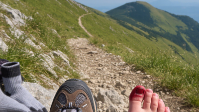 How to Stop Toenail Pain From Hiking Shoes in 2026