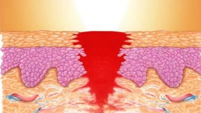 5 Essential Benefits of Choosing Effective Medicine for Wound Pain in Healthcare