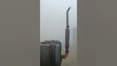 How to Perform Intramedullary Nail Procedure for Fractures?