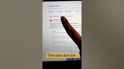 What is Nail Intramedullari and How Does it Work?
