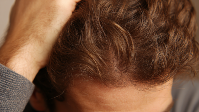 7 Essential Tips for Boosting Vitamin Hair Growth Naturally