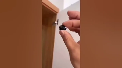 Top 10 Intramedullary Nail Benefits and Uses in Surgery?