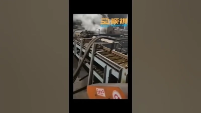 2026 Best Intramedullary Nail Options for Fractures?