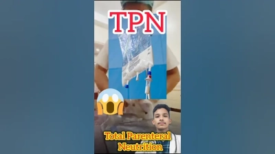 Exploring the Benefits and Uses of China Tpn Bag in Modern Healthcare