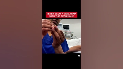 What is Nail Intramedullari and How Does It Work?