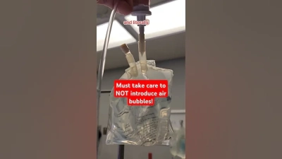 Unveiling the Benefits of Tpn Bag for Nutritional Management in Clinical Settings