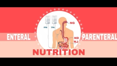 Unlocking the Benefits of China TPN Bag for Nutritional Support in Modern Medicine