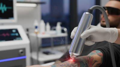 2026 Best Laser Tattoo Removal Machine Reviews and Buying Guide