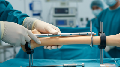 What is Nail Intramedullari and How Does it Work?