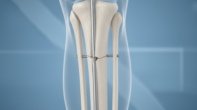 What is a Tibial Interlocking Nail and How Does It Work?