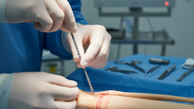 What Are Flexible Intramedullary Nails and Their Benefits?