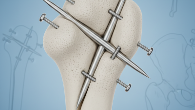 What Are Feumr Interlocking Nails and Their Benefits?