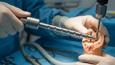 2026 Best Intramedullary Interlocking Nail for Global Buyers?