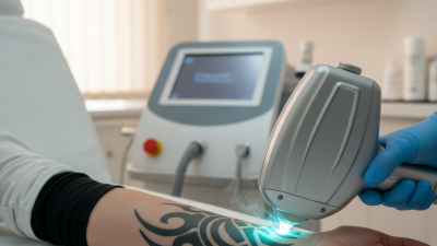 Top 10 Yag Tattoo Removal Laser Machines for Global Buyers?