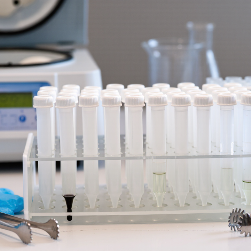 Which Is the Best PTFE Centrifuge Tube in 2026?