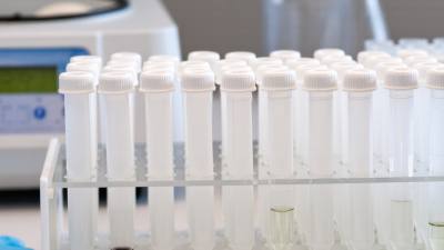 Which Is the Best PTFE Centrifuge Tube in 2026?
