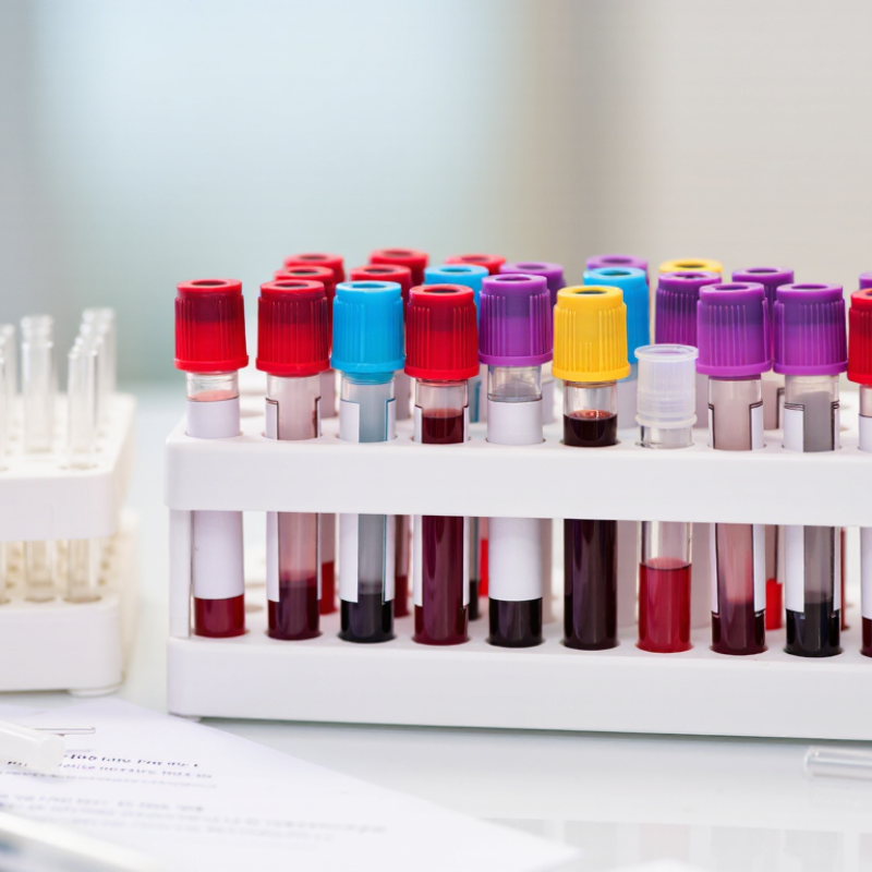 Why Are Vacutainer Tubes Used in Blood Collection?
