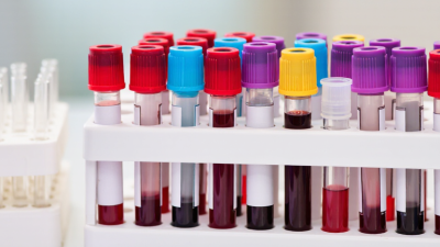 Why Are Vacutainer Tubes Used in Blood Collection?
