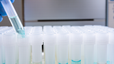 10 Tips for Buying the Best PCR Tubes?