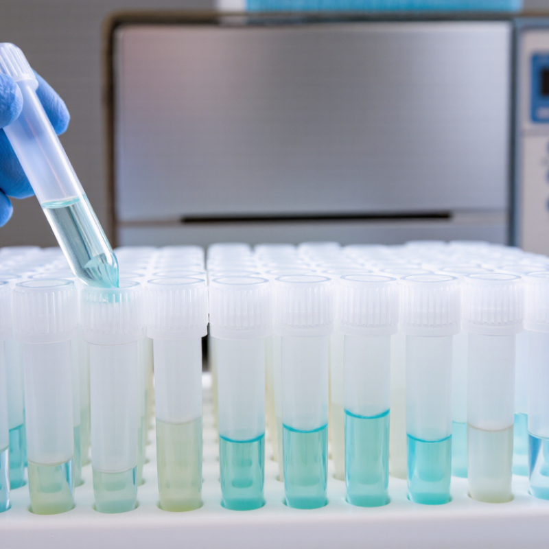 10 Tips for Buying the Best PCR Tubes?