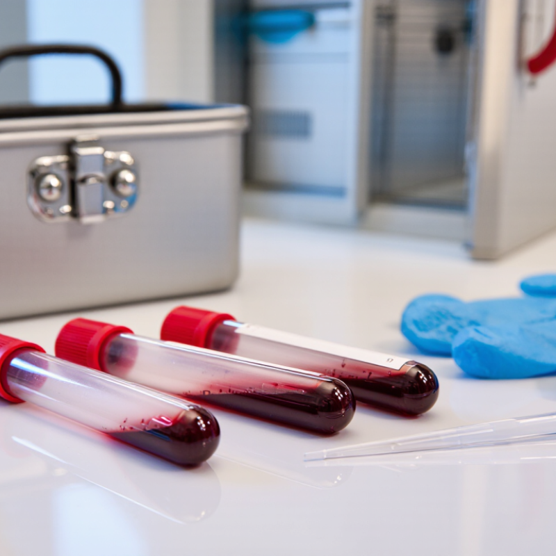Why Choose PAXgene Blood RNA Tubes for RNA Stability?
