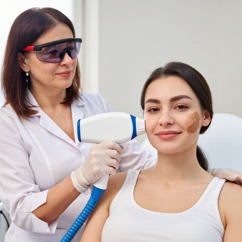 7 Tips to Find the Best Laser for Melasma Treatment?