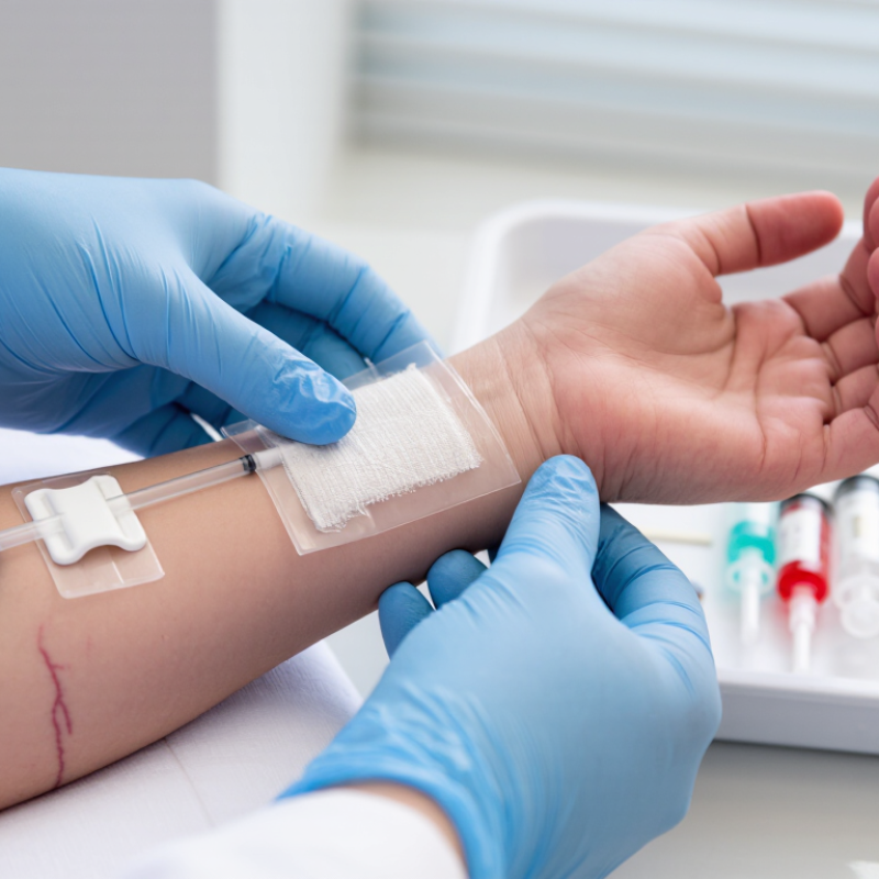 China Best IV Catheter Care How to Prevent Phlebitis?