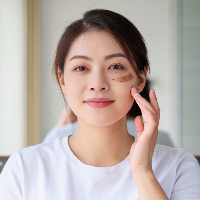 Why Do Sudden Dark Spots Appear on Your Face?