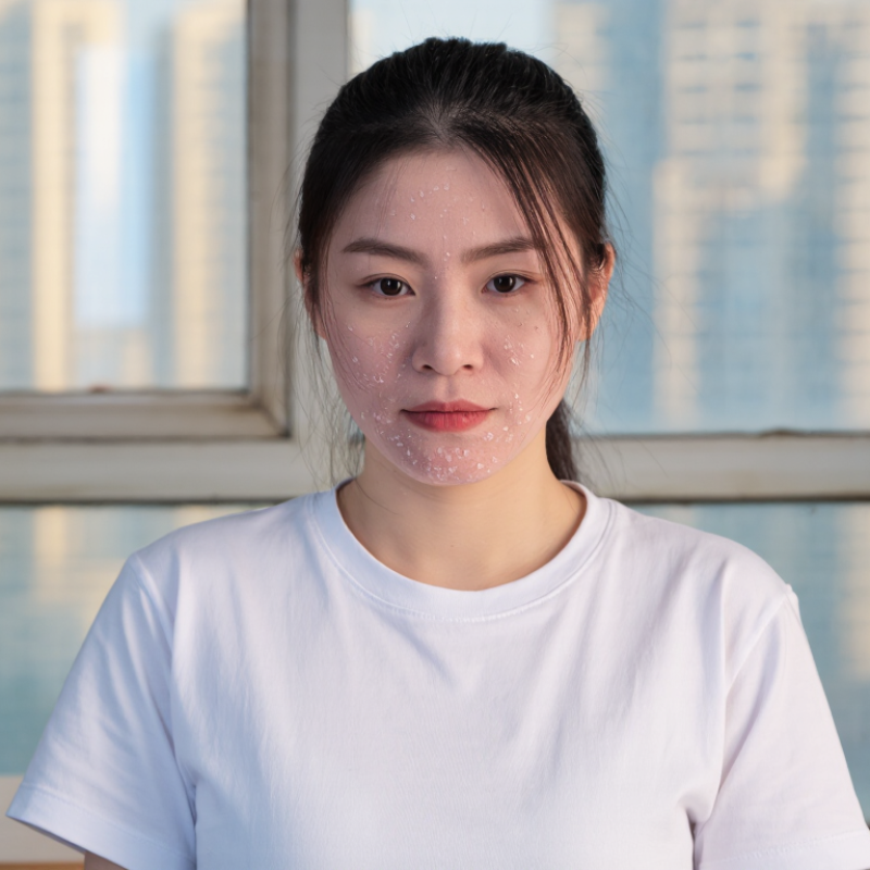 What Is Dull Skin and Why Does It Look Tired?