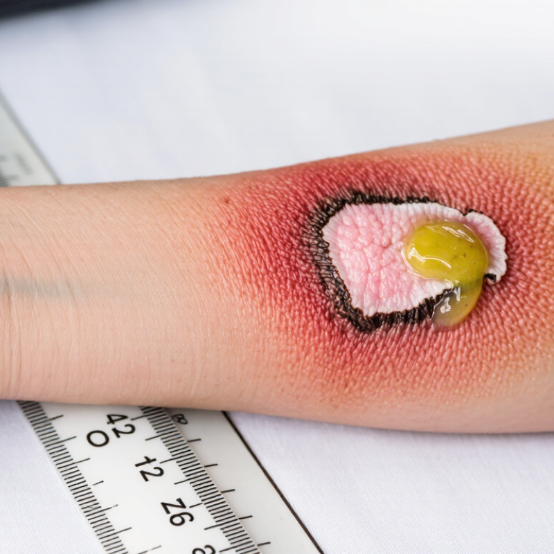 How to Identify Signs of Poor Healing?