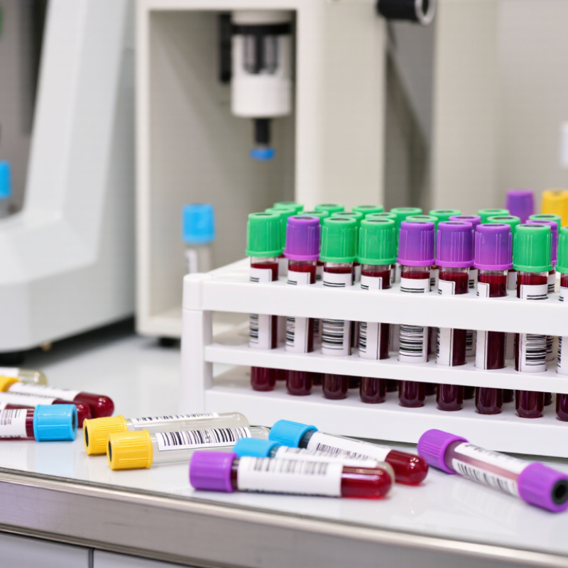 How to Choose the Right Heparin Tubes for Your Lab?