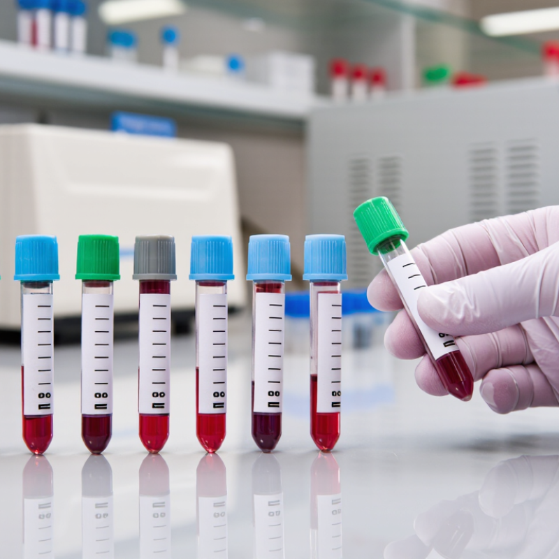 Top 10 Heparin Tubes Suppliers for Global Buyers