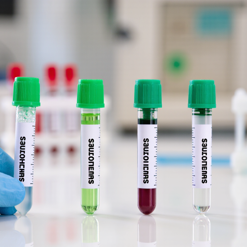 What Are the Best Heparin Tubes for Blood Testing?