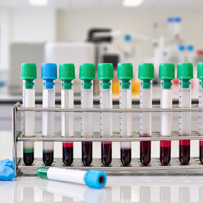 China Top 10 Heparin Tube Manufacturers for Global Buyers