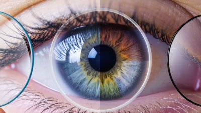 What Is the Best Type of Colored Contact Lenses?